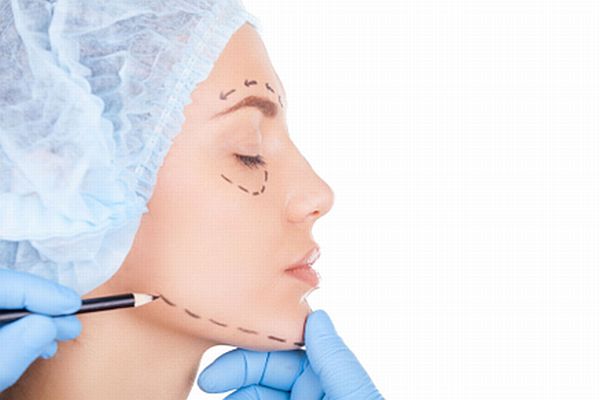 Implantes faciales