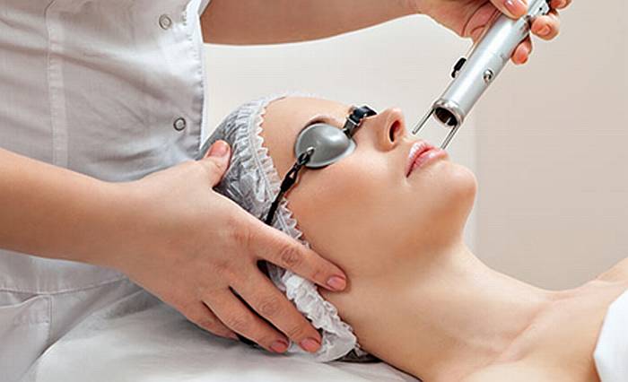 Laser Co2 Fraccionado para Cicatrices y Estrias