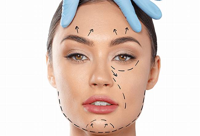 Armonización Facial - Mentón, Cuello y Pómulos