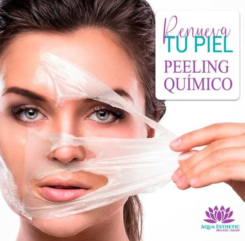 PEELING QUÍMICO