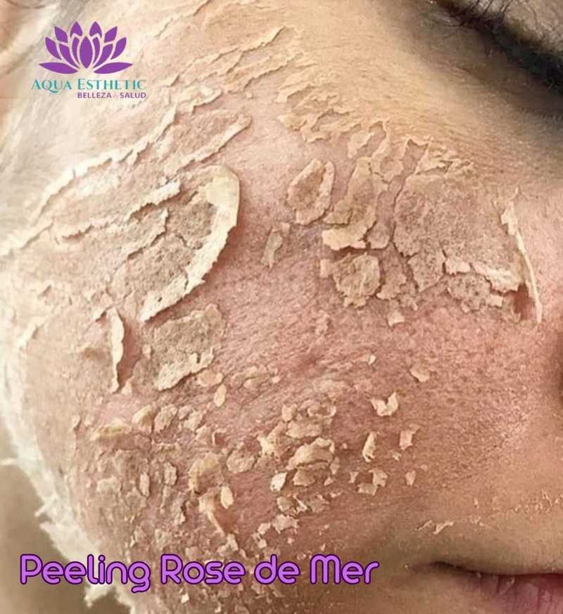 Peeling Rose de Mer