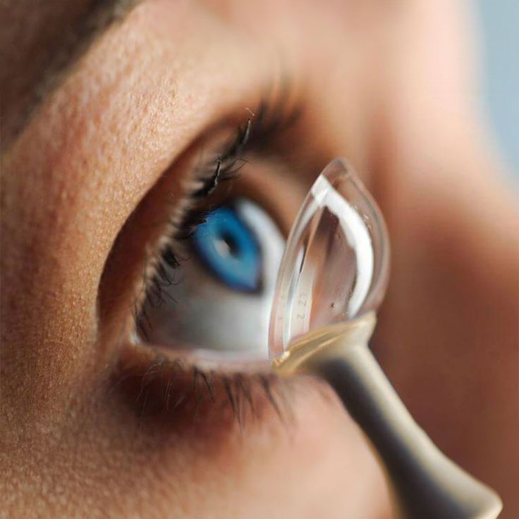 Lentes de Contacto