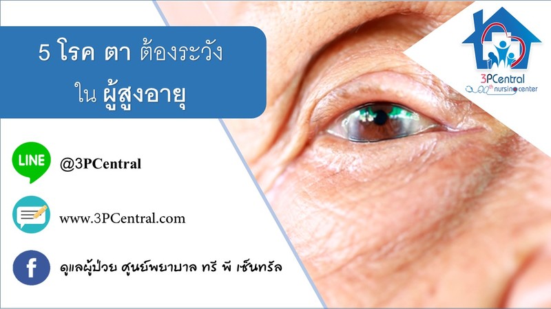 โรคตาต้องระวังในผู้สูงอายุ